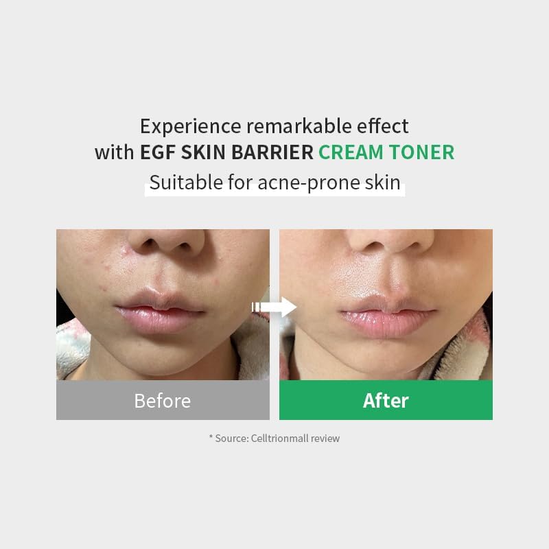 Z+PIDERM ECF Skin Barrier Cream Toner - Snipetell