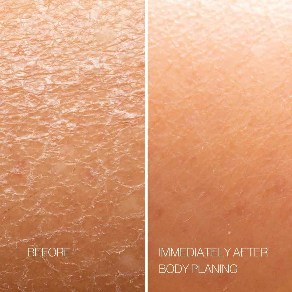 Ensemble d'outils d'exfoliation pour le corps