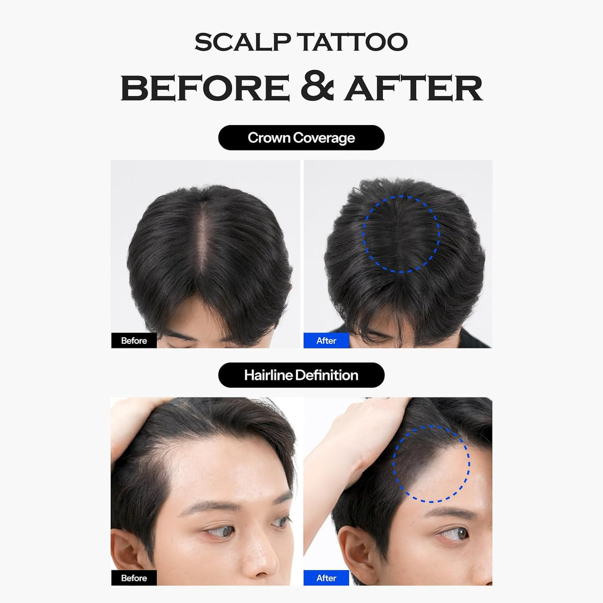 FORBEAUT Scalp Tattoo (Black) - Snipetell