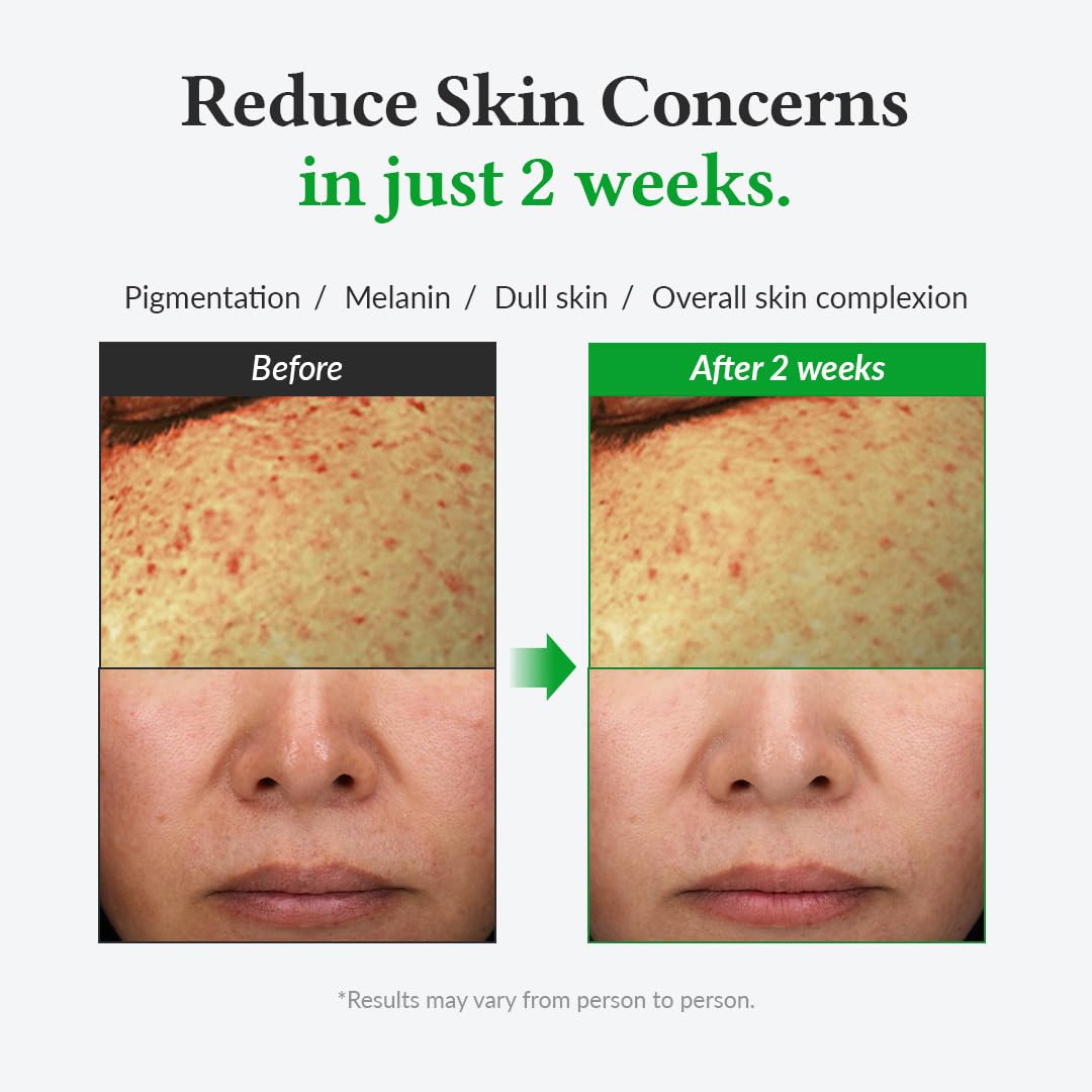 Dr. Althea Gentle Vitamin C Serum - Snipetell