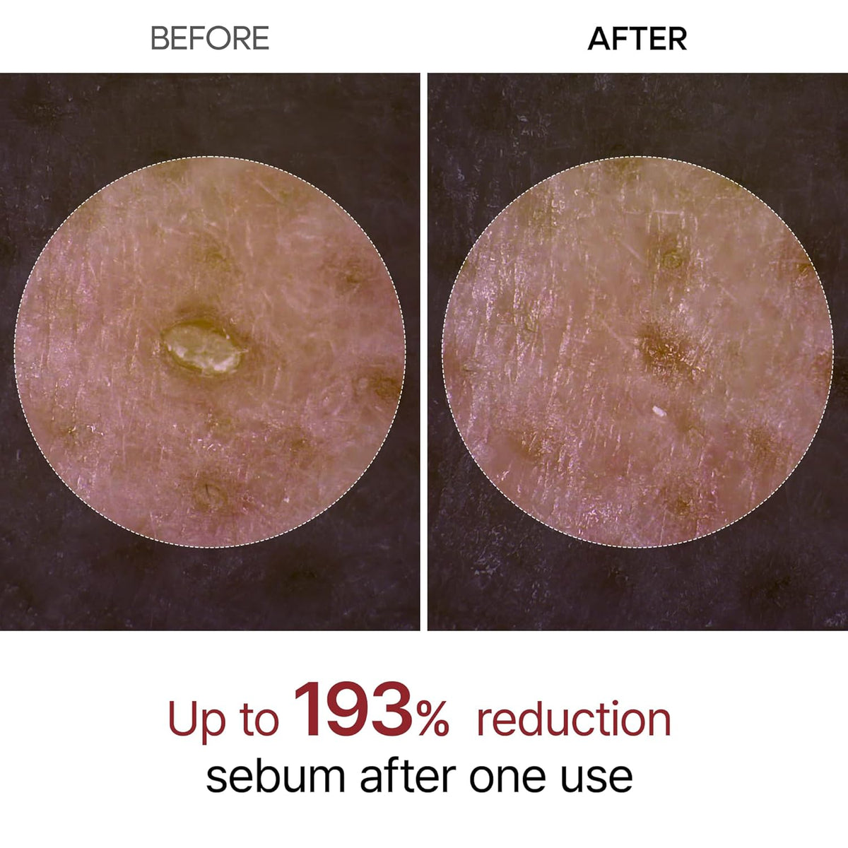 Dr. Melaxin Peel Shot Exfoliant Black Rice Ampoule - Snipetell