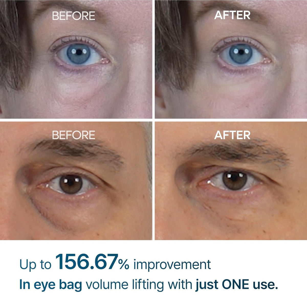 Dr. Melaxin Eyephalt Eyebag Cream - Snipetell