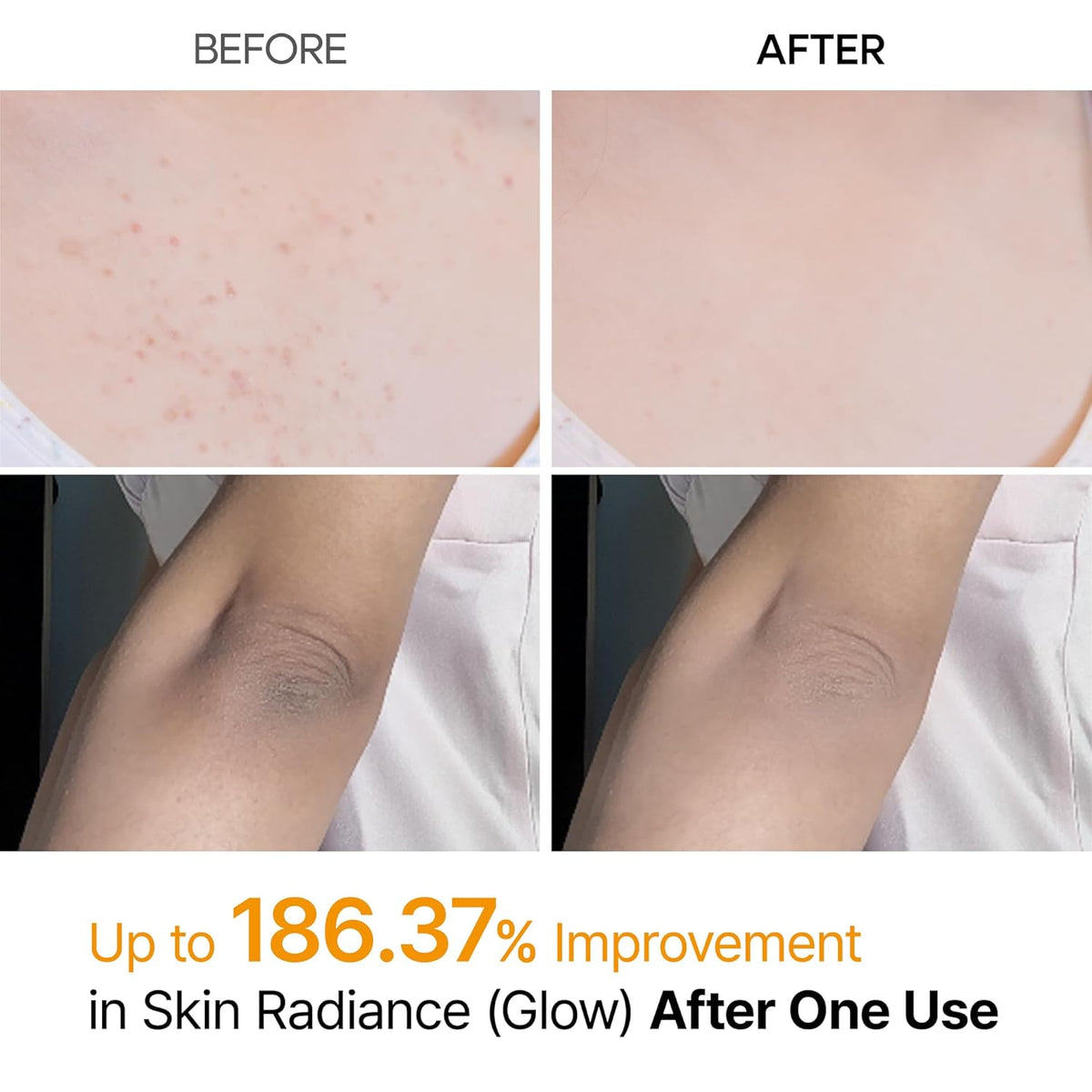 Dr. Melaxin Peel Shot Exfoliating Kojic Acid Turmeric Spray - Snipetell