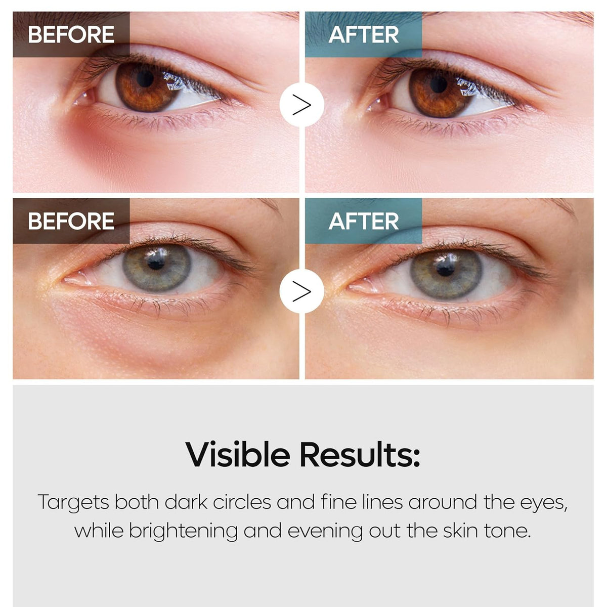 Dr. Melaxin TX Retinalsome Double Effect Eye Cream - Snipetell