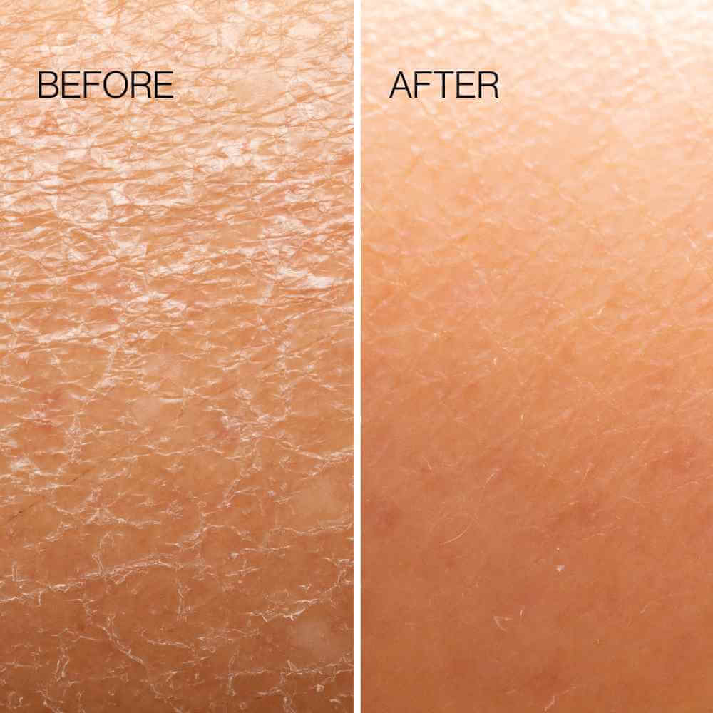 Herramienta exfoliante para el cuerpo
