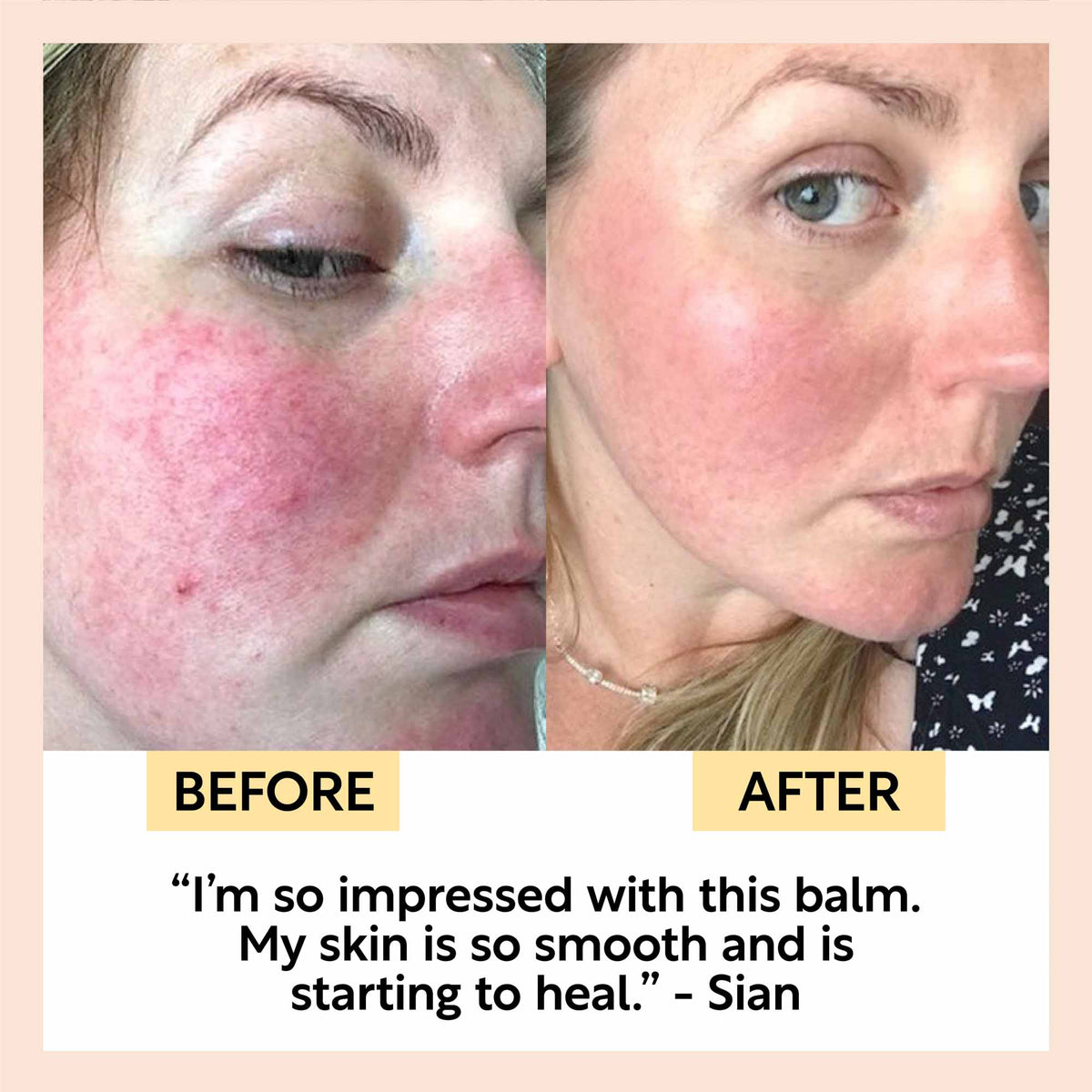 Cleansing Face Balm with Oat Oil + Vitamin E - Travel Size - Snipetell