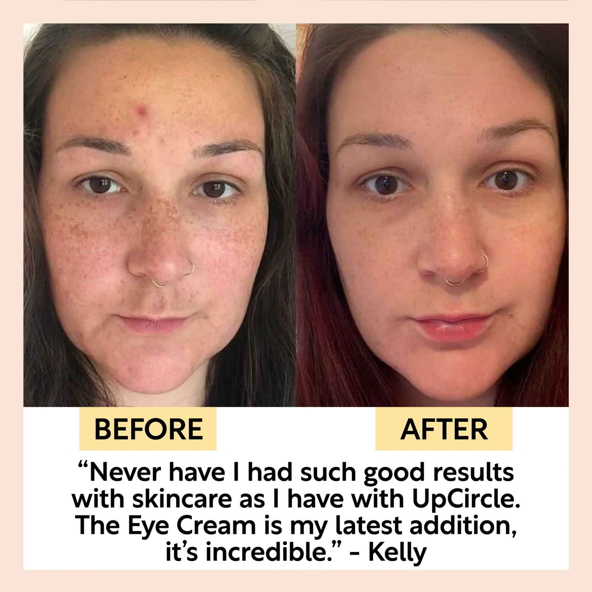 Eye Cream with Hyaluronic Acid & Coffee - Snipetell