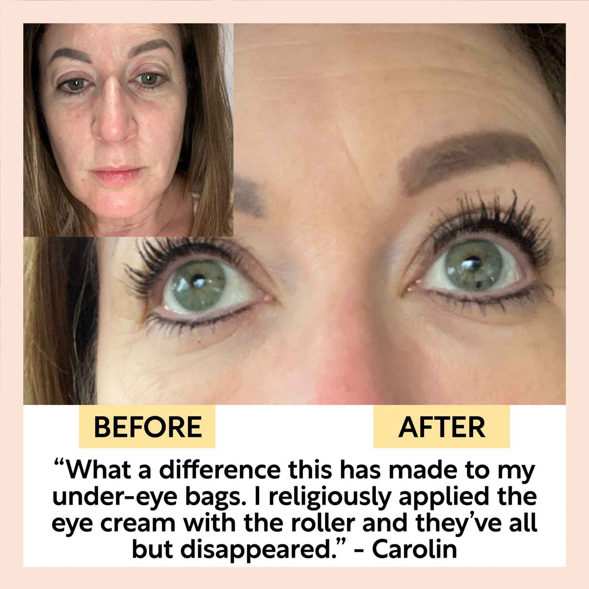 Eye Cream with Hyaluronic Acid & Coffee - Snipetell