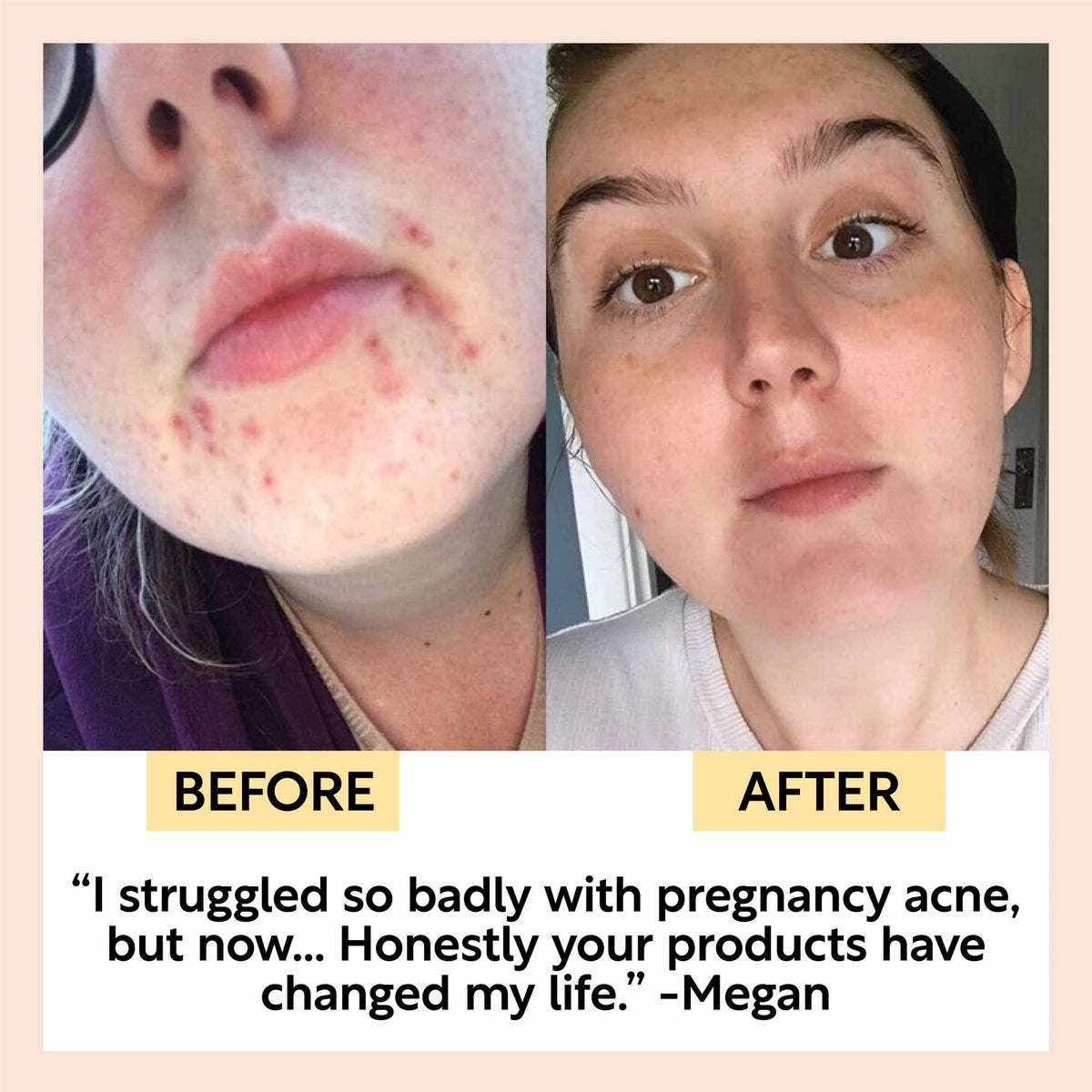 Cleanse, Tone + Moisturize Set - Snipetell