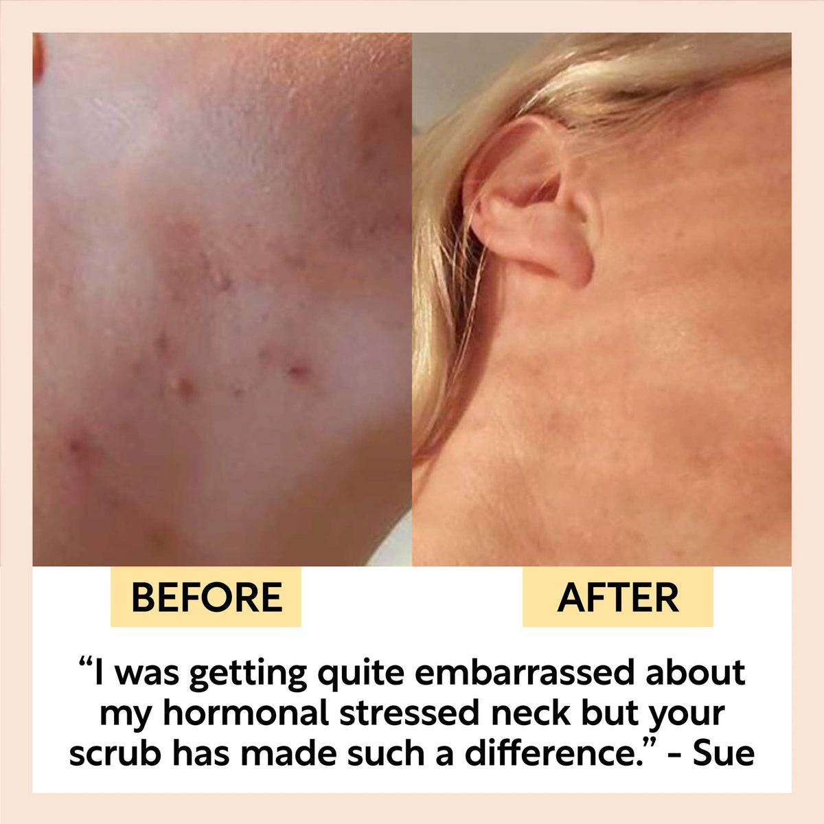 Face Scrub with Coffee + Rosehip Oil - Snipetell