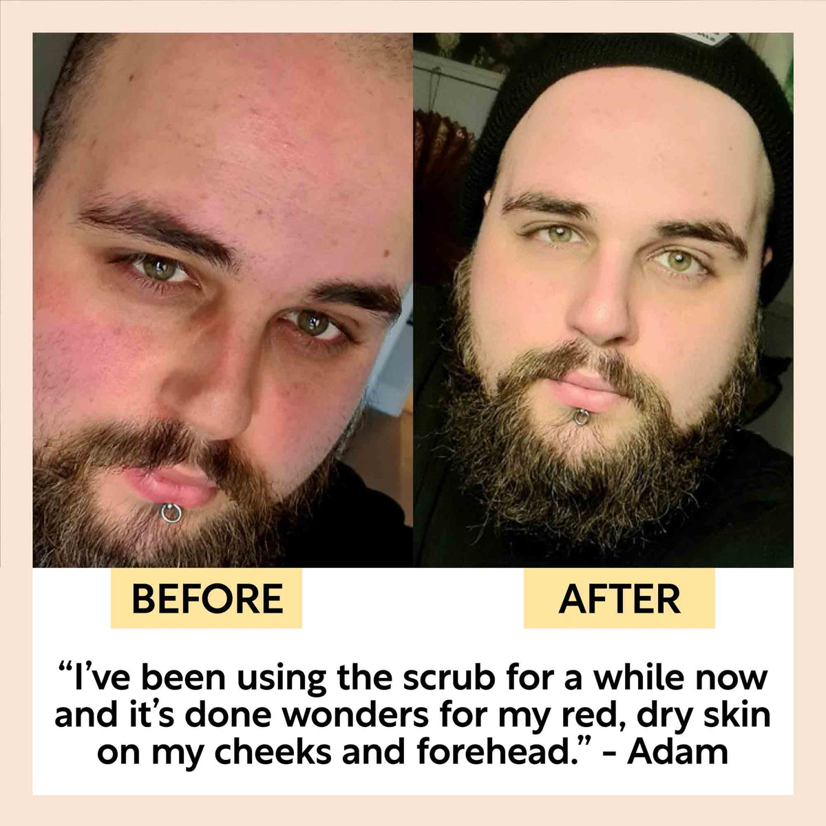 Face Scrub with Coffee + Rosehip Oil - Snipetell