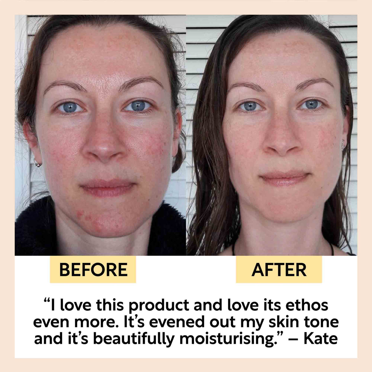 Anti-Aging Skincare Bundle - Snipetell