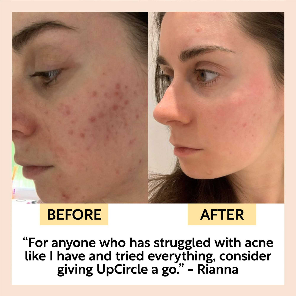 Face Toner with Hyaluronic Acid - Snipetell
