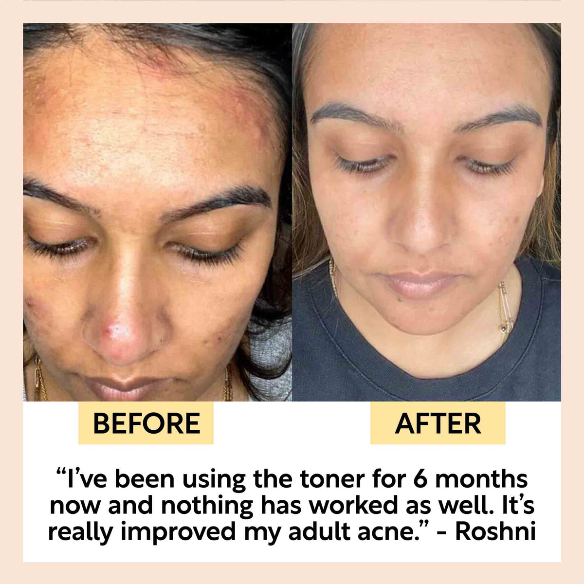 Face Toner with Hyaluronic Acid - Snipetell