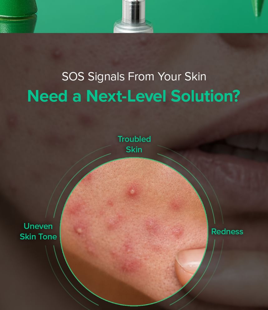 Mary & May Spicule Azelaic PDRN Spot Cream - Snipetell