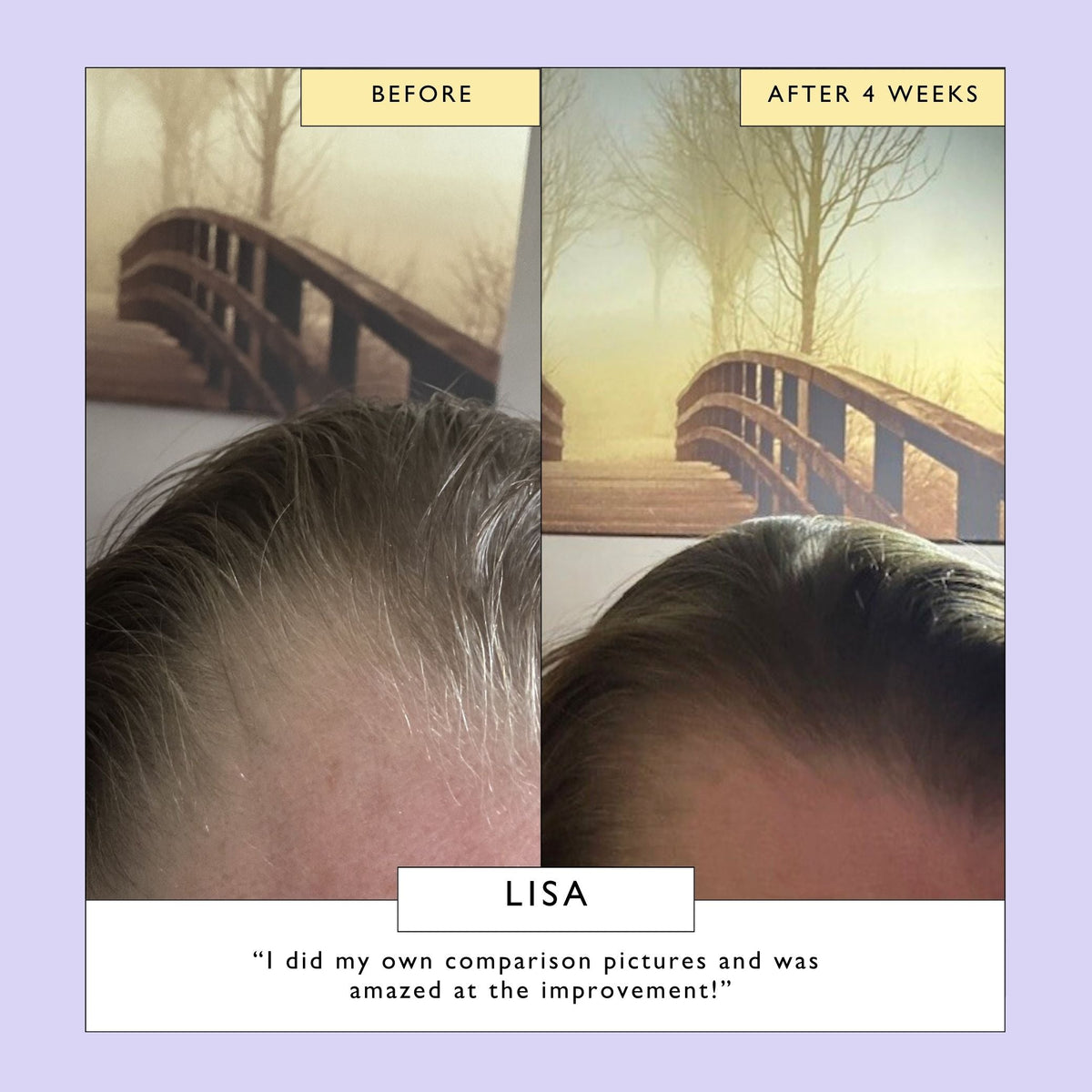 Scalp + Hair Oil with Bacuri Butter + Castor Oil - Snipetell