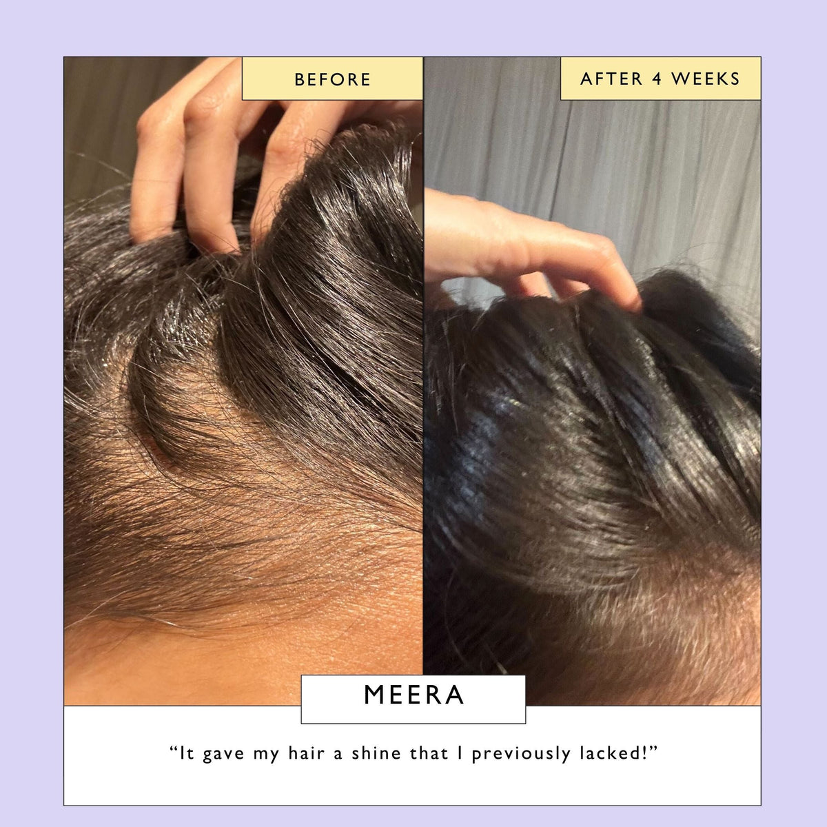 Scalp + Hair Oil with Bacuri Butter + Castor Oil - Snipetell