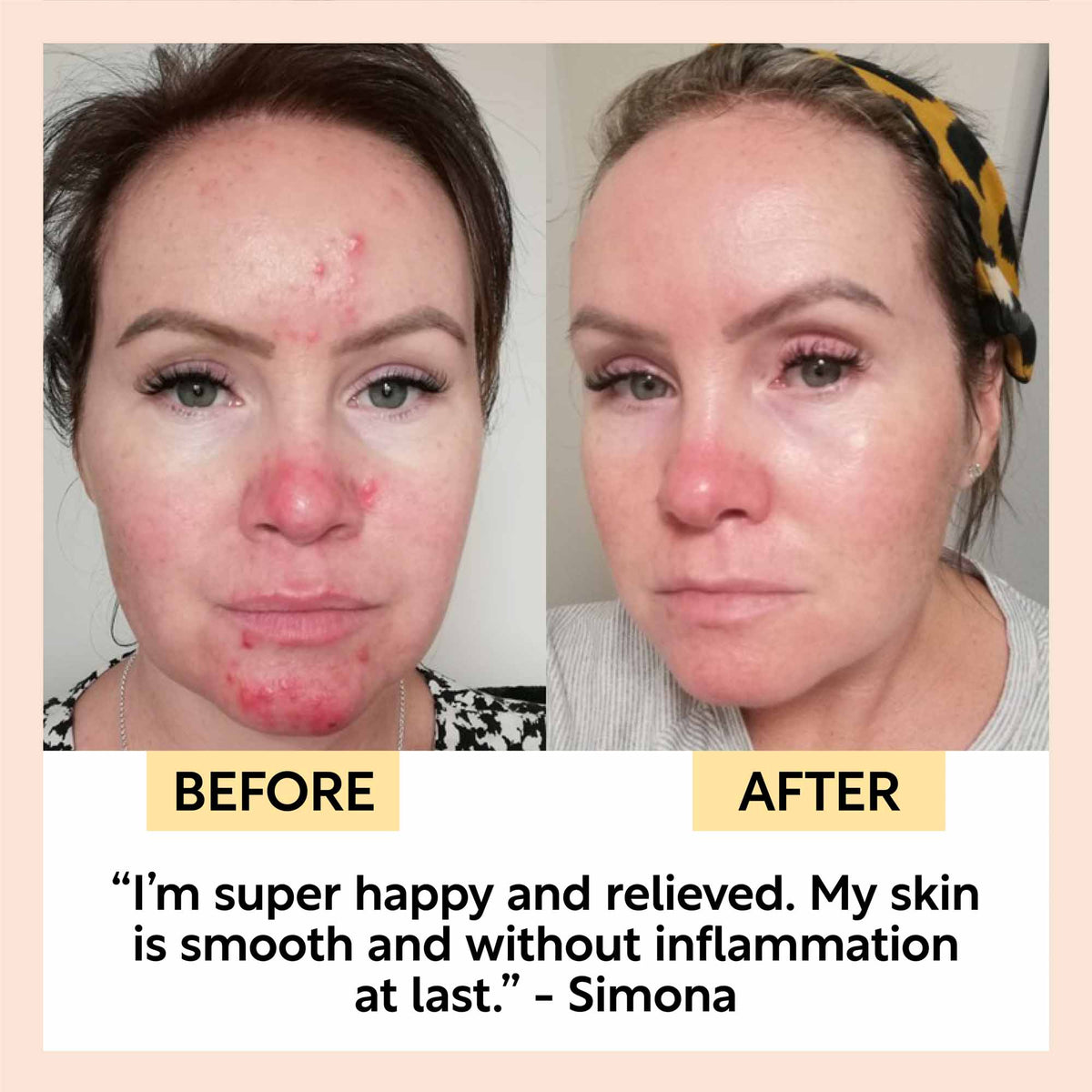 Night Cream with Hyaluronic Acid + Niacinamide - Travel Size - Snipetell