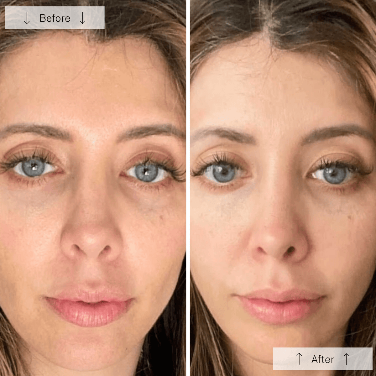 Masque LED pour le visage Omnilux Contour