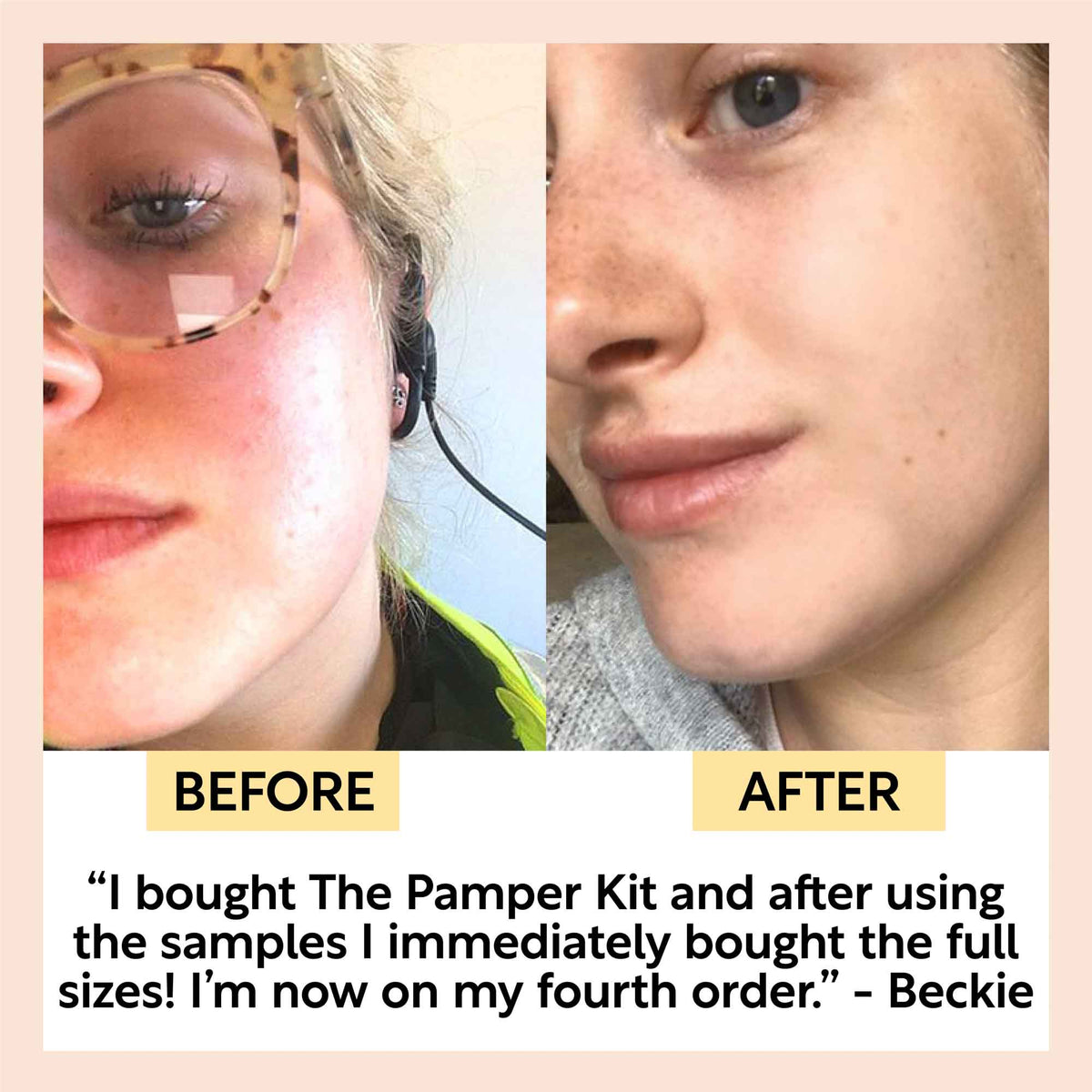 The Pamper Kit - Snipetell
