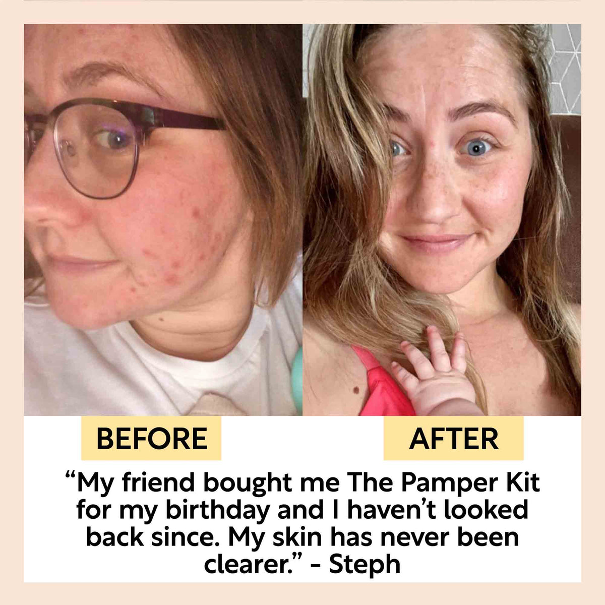 The Pamper Kit - Snipetell