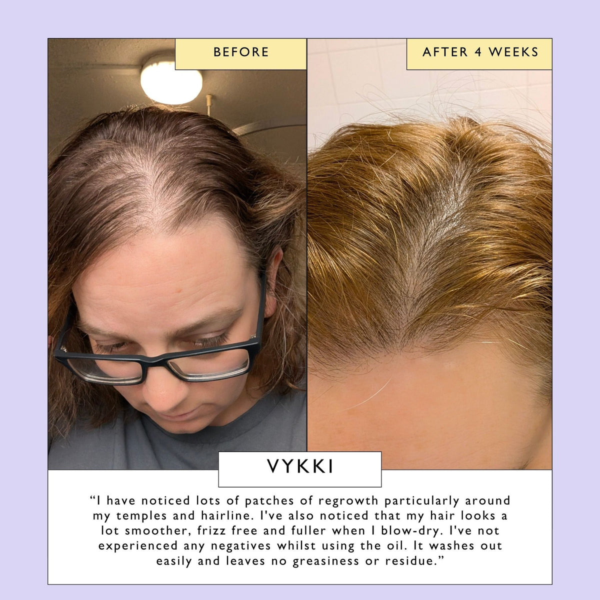 Scalp + Hair Oil with Bacuri Butter + Castor Oil - Snipetell